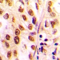 Anti-Histone Deacetylase 2 Antibody