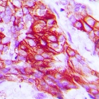 Anti-Syntaxin 1A (Phospho-S14) Antibody