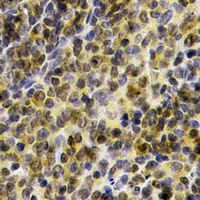 Anti-BTK Antibody