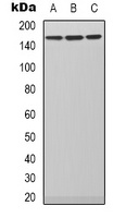 PLC beta 3 Rabbit Polyclonal Antibody