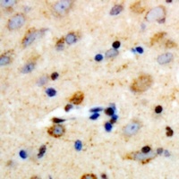 Anti-PLC beta 3 Antibody