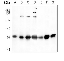 SGK1 Rabbit Polyclonal Antibody