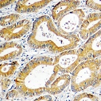 SGK1 Rabbit Polyclonal Antibody