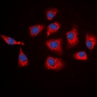 SGK1 Rabbit Polyclonal Antibody