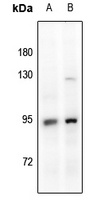 Glucocorticoid Receptor Antibody