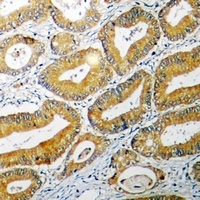 Anti-BID Antibody