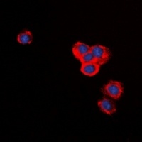 Anti-BID Antibody