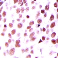 Anti-MDM2 Antibody