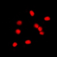 Anti-MDM2 Antibody