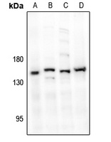 MYPT1 Rabbit Polyclonal Antibody