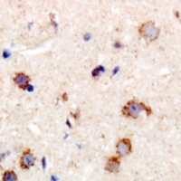MYPT1 Rabbit Polyclonal Antibody
