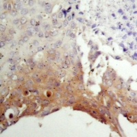 TSC2 Rabbit Polyclonal Antibody