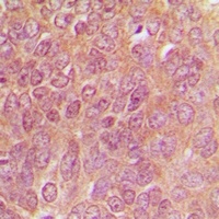 Anti-TPH1 Antibody