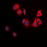 Anti-TPH1 Antibody