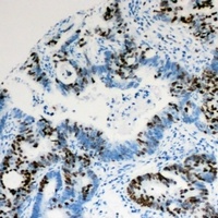 Anti-PIAS1 Antibody