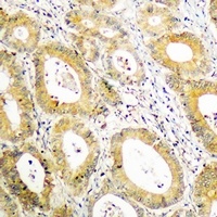 Anti-BCAR3 Antibody