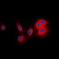 Anti-BCAR3 Antibody