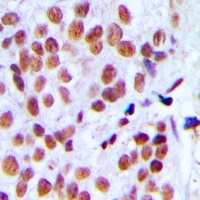 Anti-hnRNP L Antibody