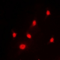 hnRNP L antibody