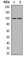 UBF Antibody