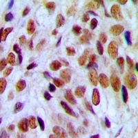 UBF Antibody
