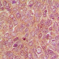 Anti-DUSP9 Antibody