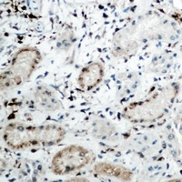 DCP1A antibody