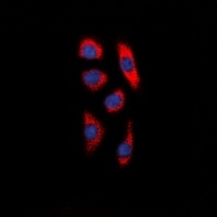 Anti-DCP1A Antibody