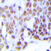 Anti-MGMT Antibody