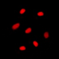 Anti-MGMT Antibody