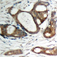 Anti-Plakophilin 2 Antibody