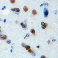 Anti-PLEKHG4 Antibody