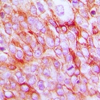Anti-EP2 Antibody