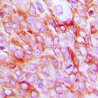 EP2 antibody