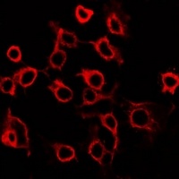 Anti-EP2 Antibody
