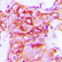 Anti-GPR101 Antibody