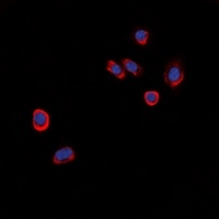 Anti-GPR101 Antibody