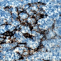 ZAP70 (phospho-Y319) antibody