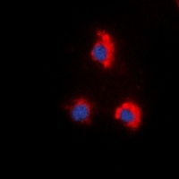 ZAP70 (phospho-Y319) antibody