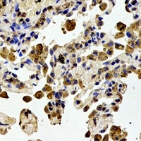 Anti-STMN1 (Phospho-S38) Antibody