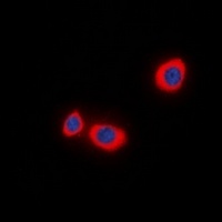 STMN1 (phospho-S38) antibody