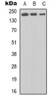 BRCA1 Rabbit Polyclonal Antibody