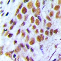BRCA1 Rabbit Polyclonal Antibody