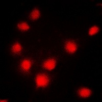 BRCA1 Rabbit Polyclonal Antibody