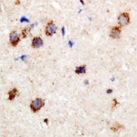 Anti-CPI17 (Phospho-T38) Antibody