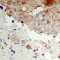 Anti-IKB epsilon (Phospho-S22) Antibody