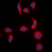 IKB epsilon (phospho-S22) antibody