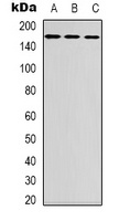 FANCD2 Antibody