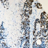 FANCD2 antibody