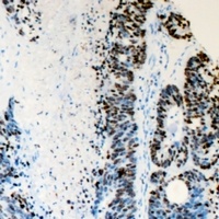 Anti-FANCD2 Antibody